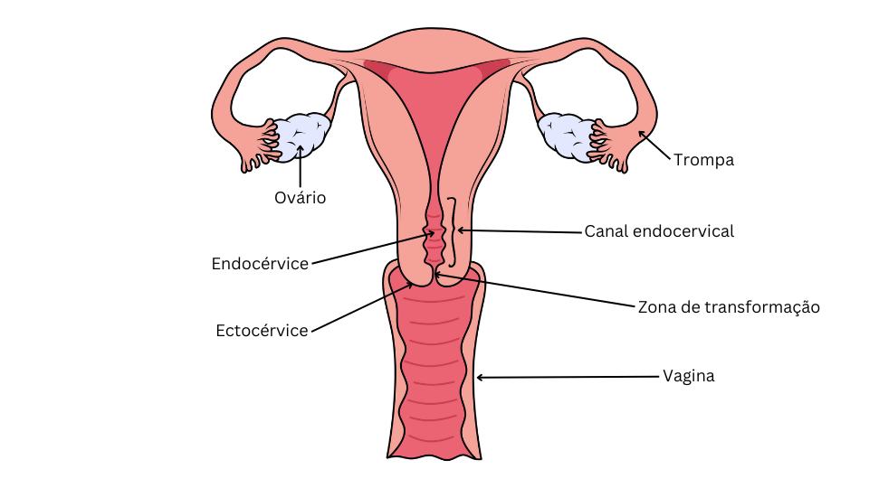 Parte do colo de útero