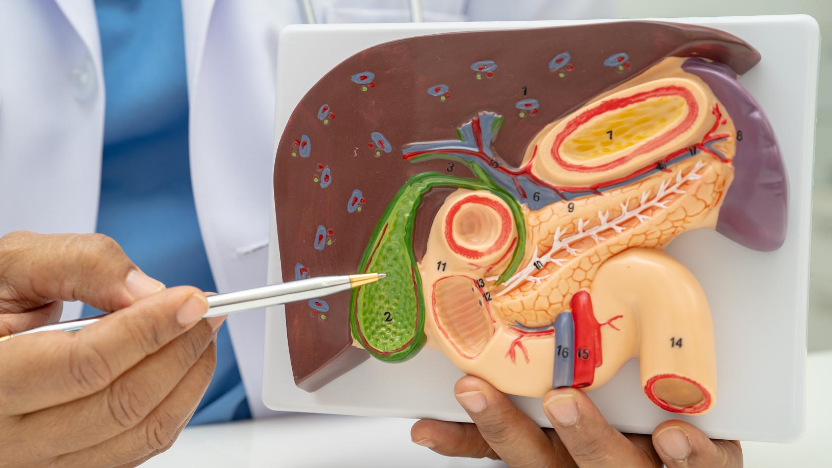 anatomia vesícula na colangigte aguda