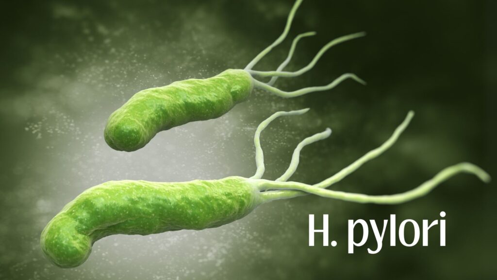 H pylory e câncer gástrico
