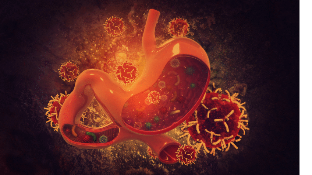 câncer gástrico