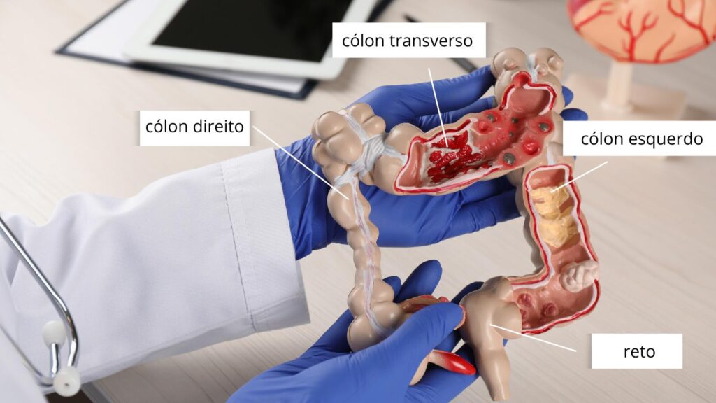 Intestino grosso